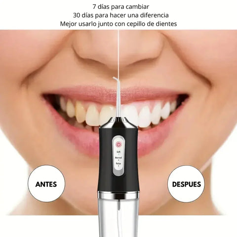 Image of IRRIGADOR DENTAL® - Portátil